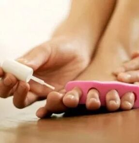 Terápiás lakk alkalmazása